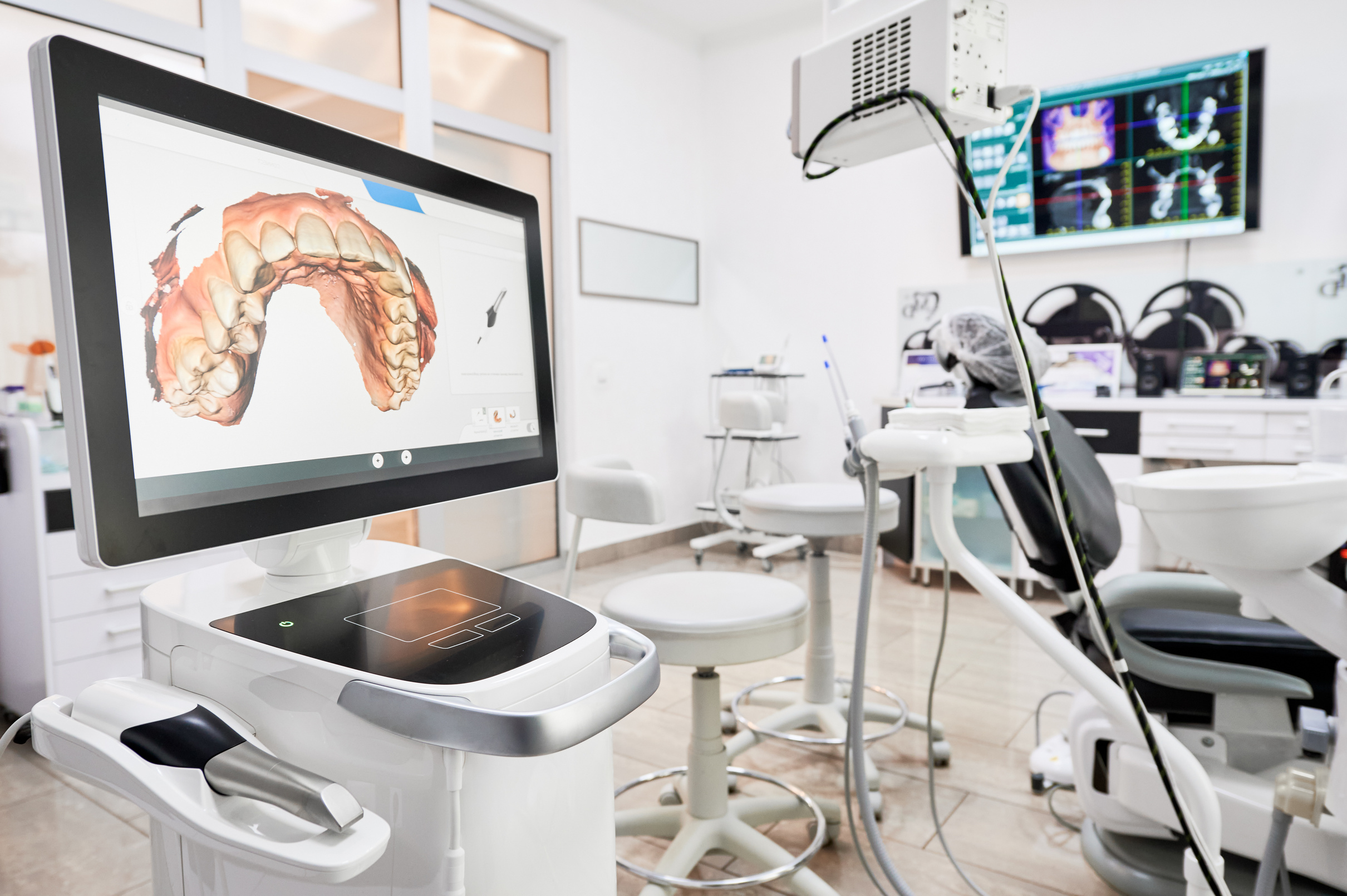 Dental intraoral scanner in modern clinic.